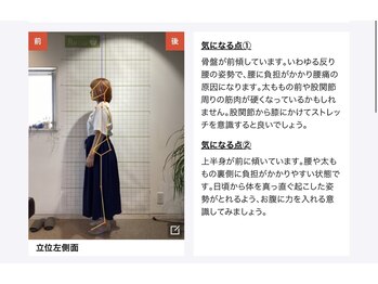 つちえ整骨院 骨盤LABO 西条店(骨盤ラボ)/身体の姿勢分析★