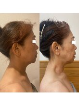 エミナル(EMINALu)/首肩凝り解消