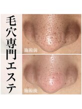 ルネッタ(Lunetta)/