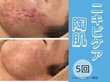 ポラリス(Polaris)/