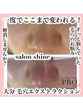 サロンシャイン(Salon Shine)/毛穴エクストラクションプロ