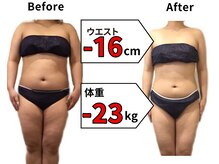 【お客様満足度★★★★★】美-Balanceが選ばれる理由★骨盤矯正×キャビテーションの人気の秘訣とは！？