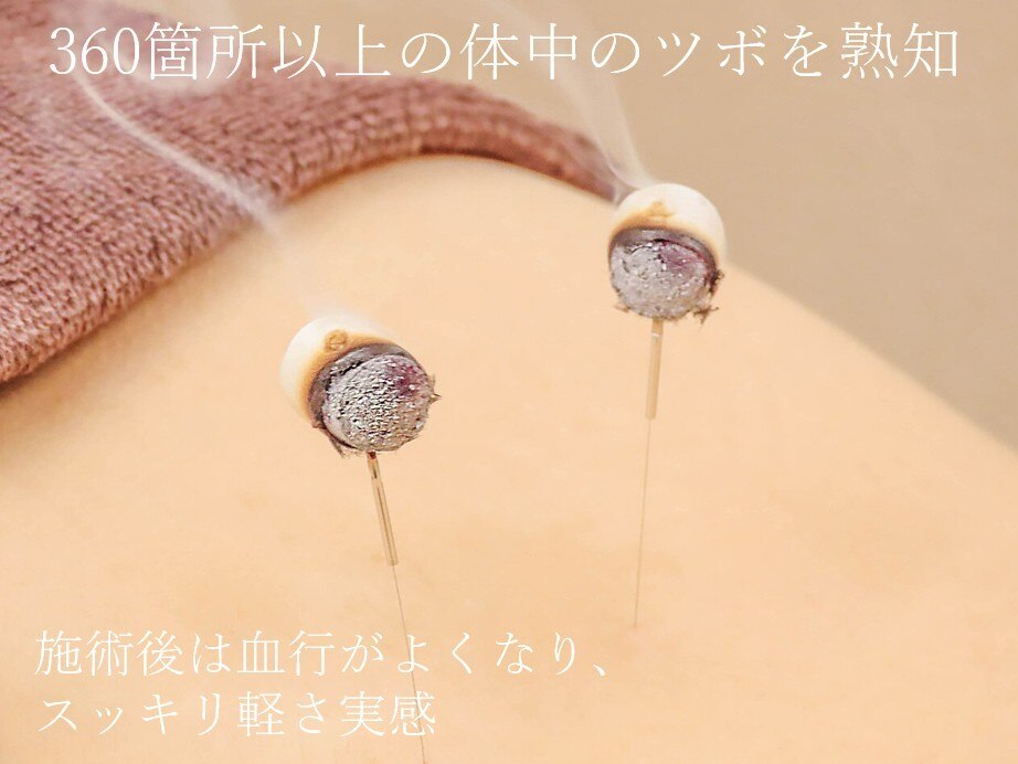 赤坂てんほう鍼灸治療院｜ホットペッパービューティー