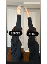 クラーレ(CURARE)/[before、after]