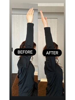 クラーレ(CURARE)/[before、after]