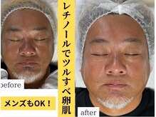 フェリス(FELIZ)の雰囲気（メンズも綺麗なお肌になりたい！そんな貴方をサポート致します◎）