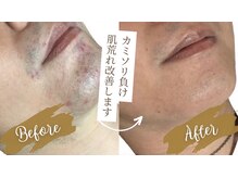 ダンディラボ(Dandy Lab)の雰囲気(大人気の髭脱毛♪価格重視リピーター続出)