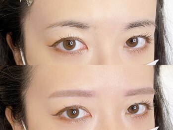 オパール 大阪梅田(op_l)の写真/【美眉＆つや肌を一度にgetで好印象へ！】眉毛+貴方に合わせた美肌menuでニキビケア＆毛穴ケア！