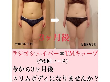 エステティックサロン エポック(epoque)の写真