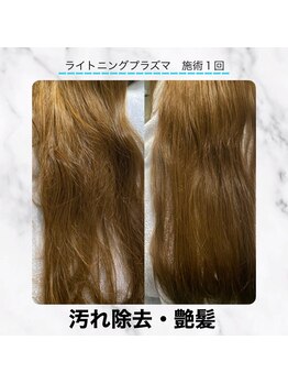 エクラ 六本木(eclat)/プラズマスカルプ