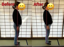 シームルの雰囲気（１回の猫背矯正で巻き肩、前重心、円背が改善し若々しい姿勢へ）