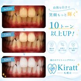 キラット 札幌店(Kiratt)