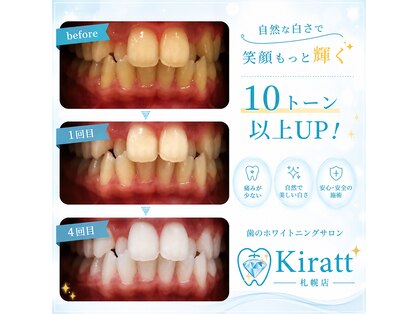 キラット 札幌店(Kiratt)の写真