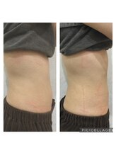 ヴィータローズディセ 名古屋本店(VITA ROSE Desse)/オーダーメイドボディ