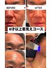 6月限定【エアーポテンツァ×エクソソーム直打】エイジング¥22000