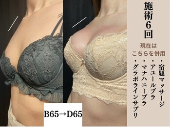 ソワ(soie)/サイズUPして憧れの谷間が出現