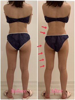 スペチアーレ 夙川/女性らしい美ボディに