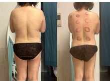 オーシャンブルーム 目黒(OceanBloom)/たった１回90分