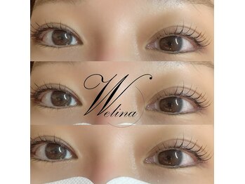 ウェリナ(welina)/