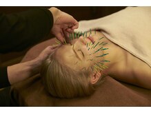 カドモリ 心斎橋(KADOMORI)/【美容鍼/大阪美容鍼/小顔矯正】