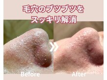 オーエスガーデン 帯広(OS Garden)の雰囲気（【毛穴洗浄】ハイドロスプラッシュで鼻のブツブツ解消★）