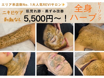 ラペカ(Lapeca)の写真