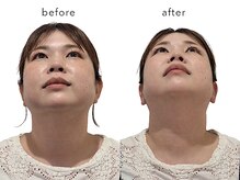 レジスタ(REGISTA)/【首のこり】