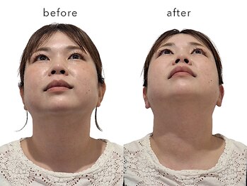 レジスタ(REGISTA)/【首のこり】