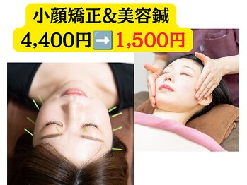 鍼灸院ウルハ(鍼灸院URUHA)の写真/《話題沸騰♪》【美容鍼でお顔周りをスッキリ♪】お顔のむくみ改善+ハリツヤがUP◎美容鍼4400円→1500円