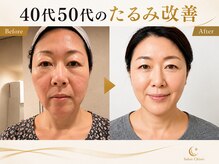 サロンチオリ 烏丸(Salon Chiori)