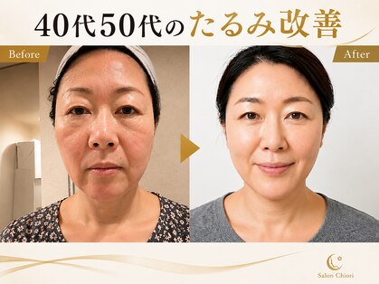 サロンチオリ 烏丸(Salon Chiori)の写真