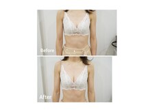 レイジア(regia)の雰囲気（谷間の違いに感動！肩や背中の凝りも◎筋膜リリースで猫背も改善）