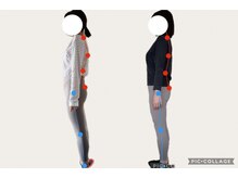 フォーシー(4C)/Before/After