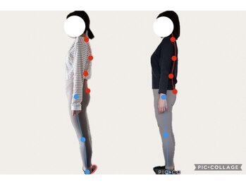 フォーシー(4C)/Before/After