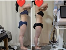 ひぺりかむ/月1回【お身体のメンテナンス】