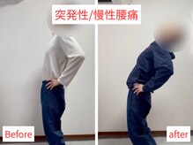 活法術 福岡整体院/腰の痛み改善！