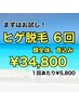 【男性】ヒゲ脱毛(顔全体、首込み) 6回