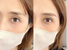 チルアンドアイ 千葉駅前店(Chill&Eye)/美眉スタイリング/BeforeAfter