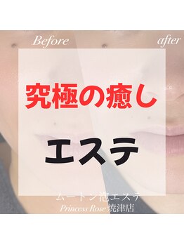 プリンセスローズ 焼津店(Princess Rose)/▼▼▼エステ▼▼▼
