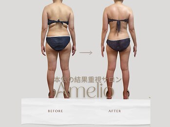 アメリオ(Amelio)/ビフォーアフター40代後半