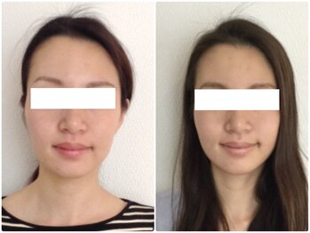 美容整体 ウェリナ 蟹江院/小顔矯正/骨盤矯正/美脚サロン