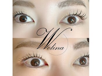 ウェリナ(welina)/