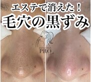 フォーエアリー(4+airuy)