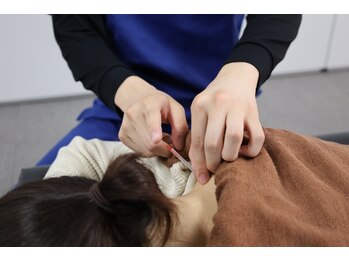 小林整骨院 本院の写真/【鍼灸施術】心と体を整える、本格鍼灸で体内改善