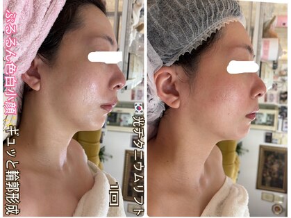 アルページュ(Arpege)の写真