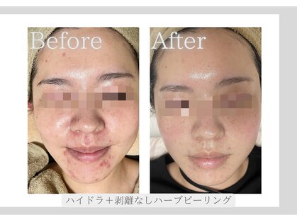 ベル(Belle)の写真