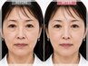 【究極の小顔】３０代以上の方におすすめ！☆先端マシンのスペシャルコース☆