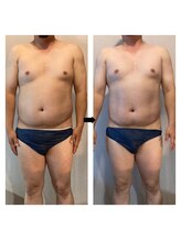 伊達男/フォースカッター事例