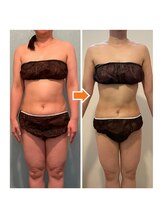 サルサナ(Salu Sana)/50代前半でも若見えするBODYへ