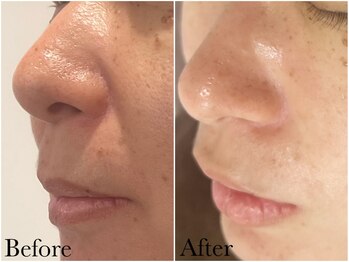 アンベリール(embellir.)/セルマンスキンケアメソッド